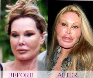 Jocelyn Wildenstein