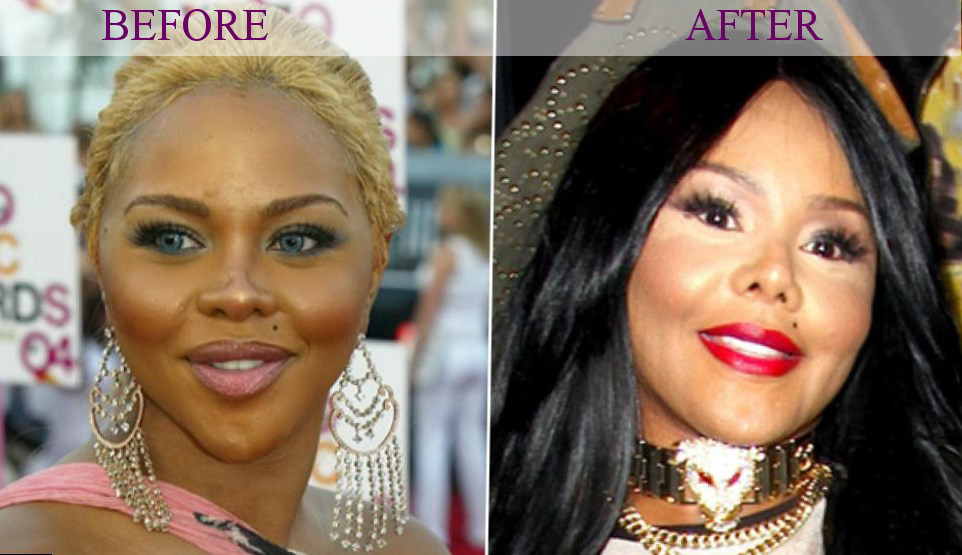 Lil-Kim