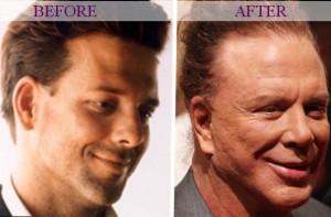 Mickey Rourke