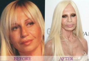 Celecrities bad surgery