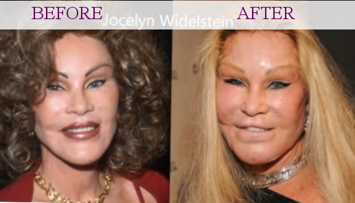 Jocelyn Wildenstein