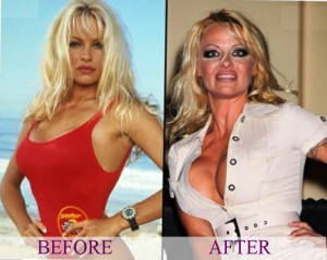 Pamela Anderson