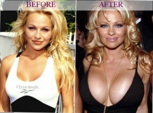 Celecrities bad surgery