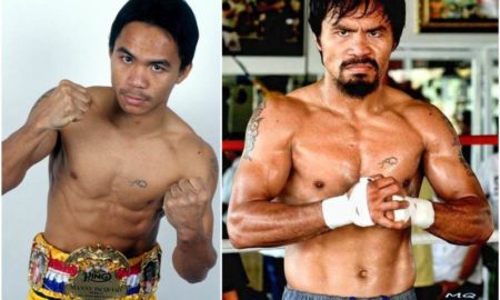 Manny Pacquiao`s eyes and hair color