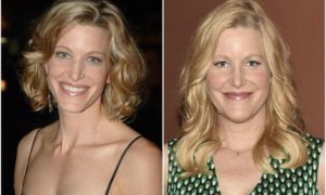 Anna Gunn's eyes and hair color