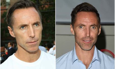 Steve Nash's eyes and hair color