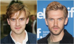 Dan Stevens' eyes and hair color