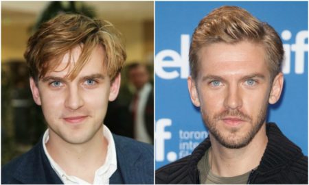 Dan Stevens' eyes and hair color